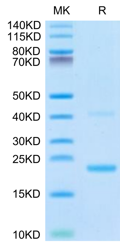 Biotinylated Mouse IL-21 on Tris-Bis PAGE under reduced condition. The purity is greater than 95%.Biotinylated Mouse IL-21 Protein
