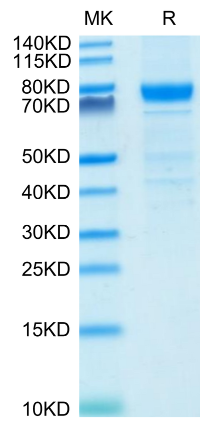 Human IL-3 R alpha on Tris-Bis PAGE under reduced condition. The purity is greater than 90%.Recombinant Human IL-3 R alpha/CD123 Protein, Active