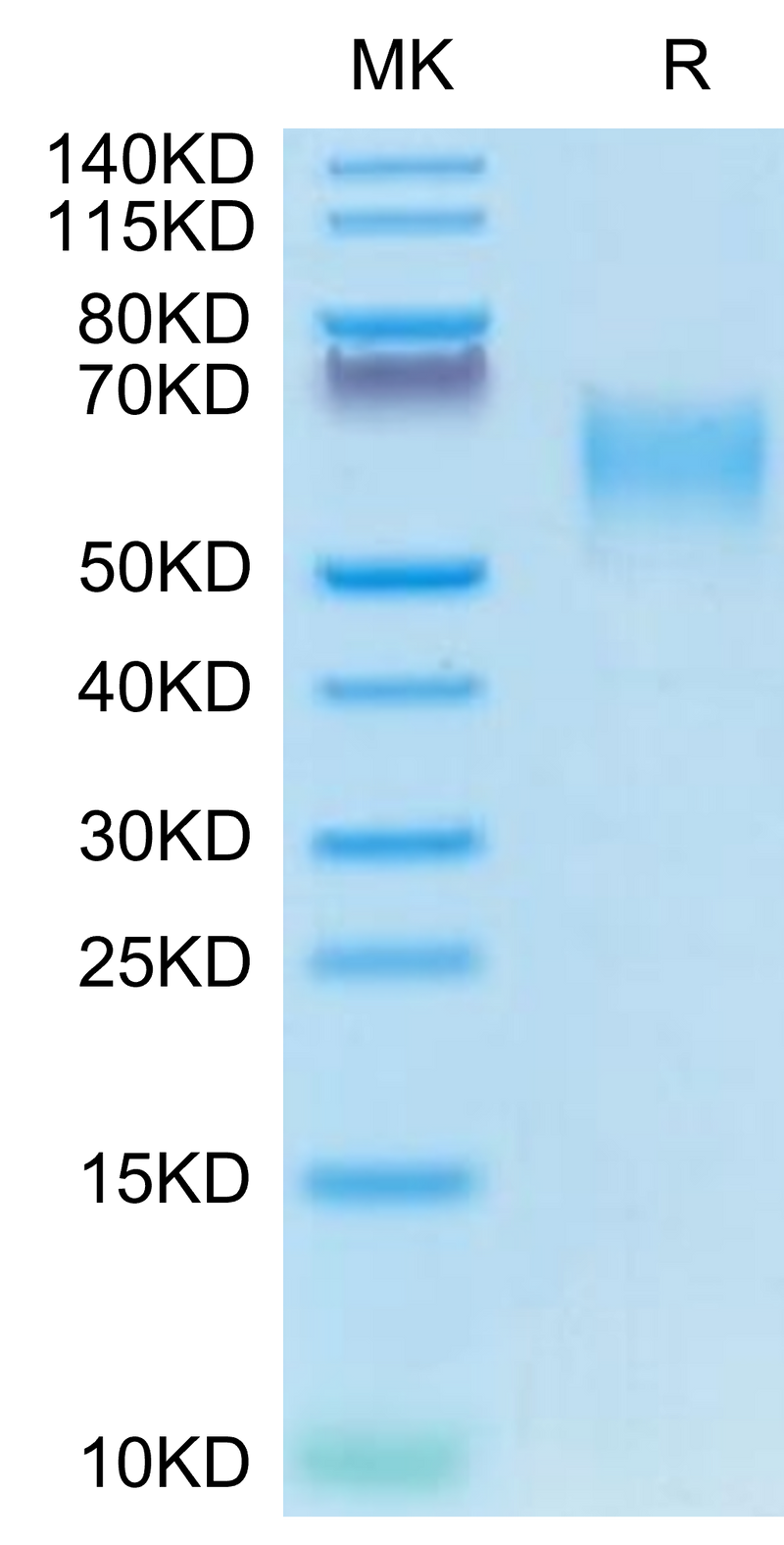 Canine CD28 on Tris-Bis PAGE under reduced condition. The purity is greater than 95%.