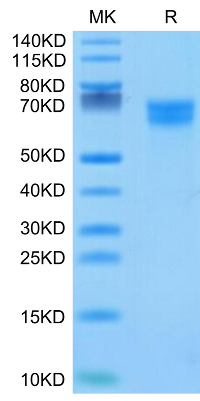 Human IL-18 R1 on Tris-Bis PAGE under reduced condition. The purity is greater than 95%.Recombinant Human IL-18 R1/CD218a Protein, Active