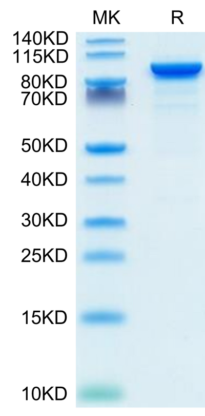 Mouse ENPP-2 on Tris-Bis PAGE under reduced condition. The purity is greater than 95%.Recombinant Mouse ENPP-2/Autotaxin Protein