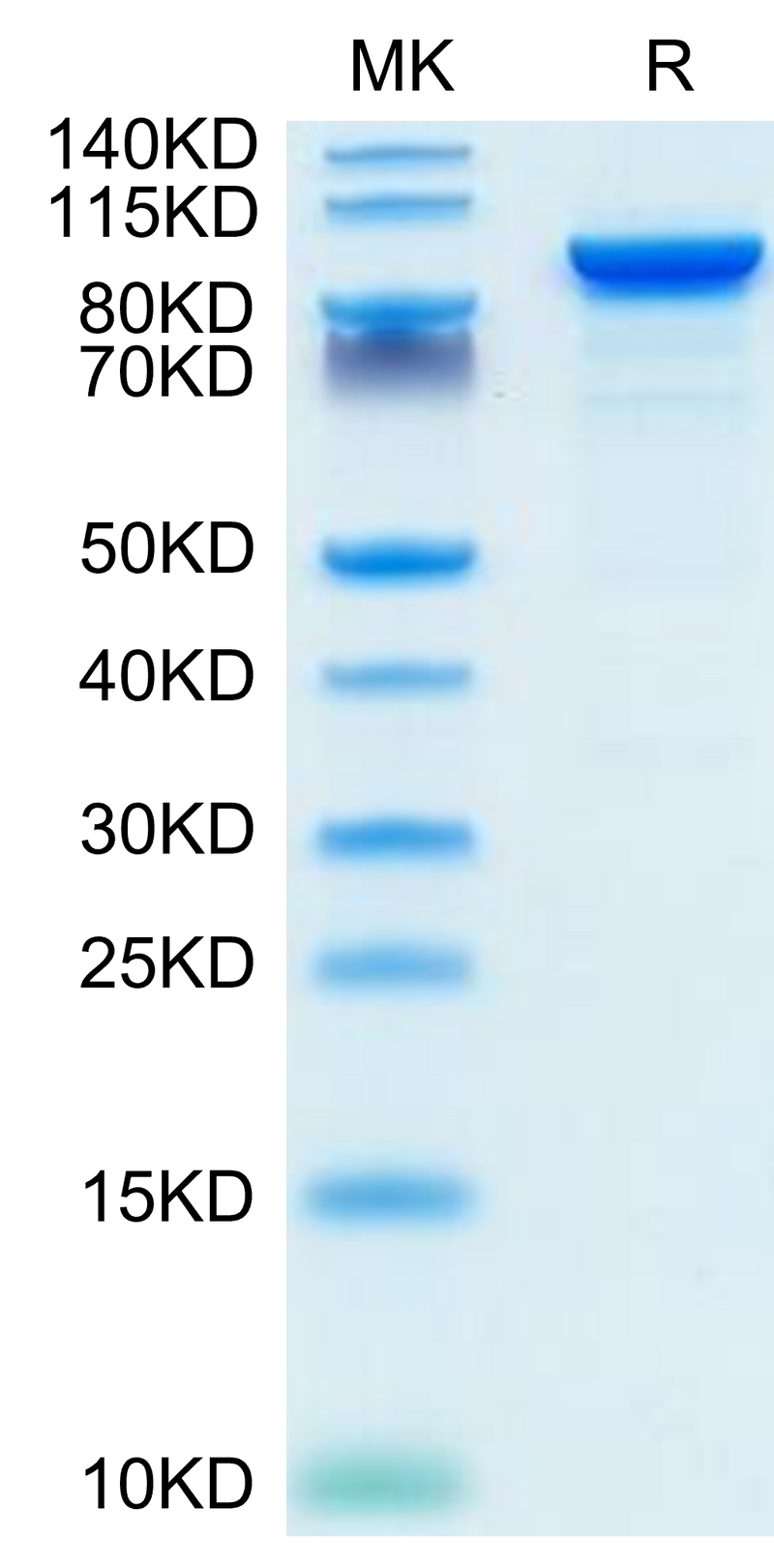 Mouse ENPP-2 on Tris-Bis PAGE under reduced condition. The purity is greater than 95%.Recombinant Mouse ENPP-2/Autotaxin Protein