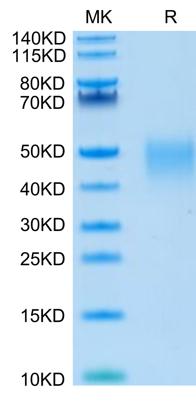 Human LIF on Tris-Bis PAGE under reduced condition. The purity is greater than 95%.Recombinant Human LIF Protein, Active