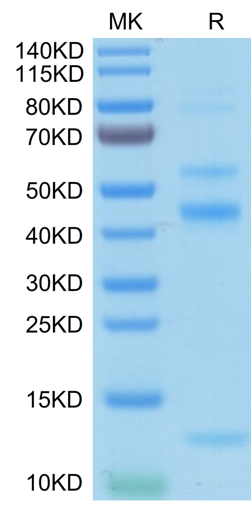 Human Latent TGF beta 2 on Tris-Bis PAGE under reduced condition. The purity is greater than 95%.
