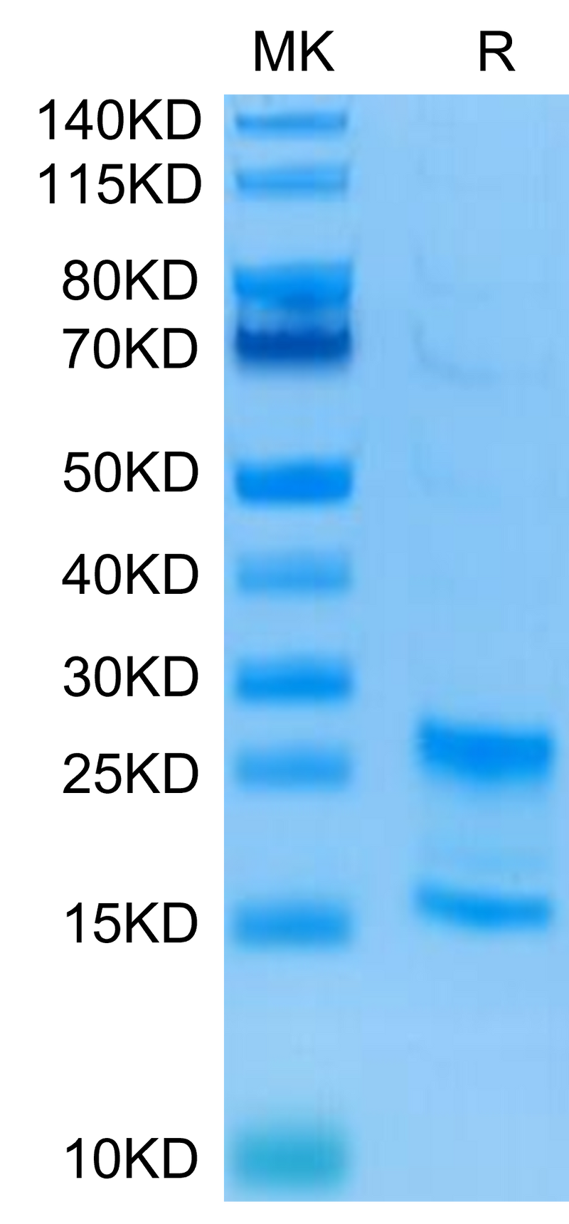 Human IL-17A&F on Tris-Bis PAGE under reduced conditions. The purity is greater than 95%Recombinant Human IL-17A&F Protein, Active