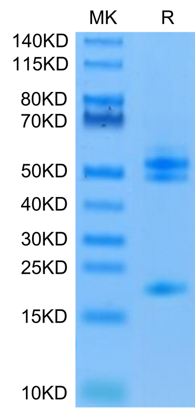 Human IL-23 alpha&Mouse IL-12 beta on Tris-Bis PAGE under reduced condition. The purity is greater than 95%.Recombinant Human IL-23 alpha&Mouse IL-12 beta Protein, Active