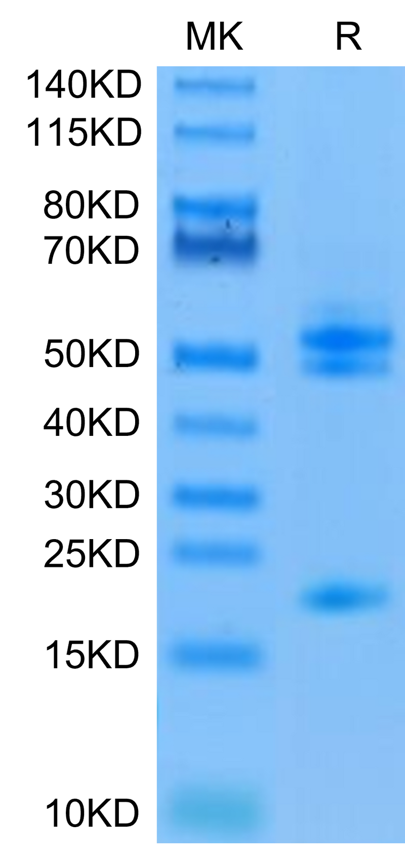 Human IL-23 alpha&Mouse IL-12 beta on Tris-Bis PAGE under reduced condition. The purity is greater than 95%.Recombinant Human IL-23 alpha&Mouse IL-12 beta Protein, Active