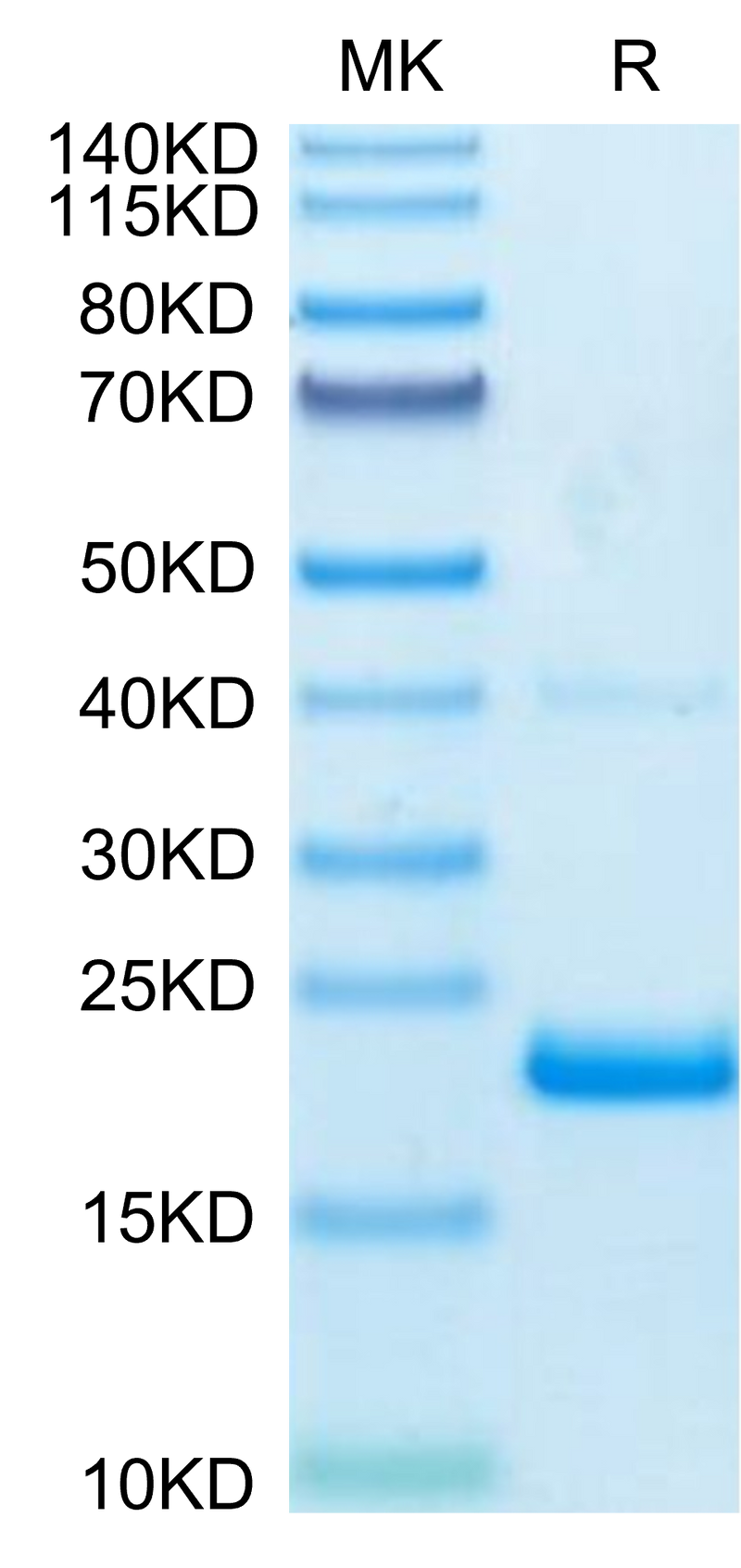Biotinylated Human TNF alpha on Tris-Bis PAGE under reduced condition. The purity is greater than 95%.Biotinylated Human TNF alpha Protein, Active