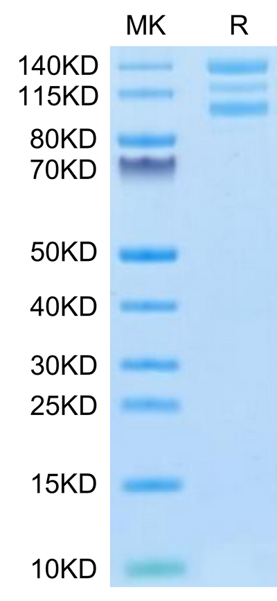 Human ITGAV&ITGB6 on Tris-Bis PAGE under reduced conditions. The purity is greater than 95%.Recombinant Human Integrin alpha V beta 6 (ITGAV&ITGB6) Heterodimer Protein, Active