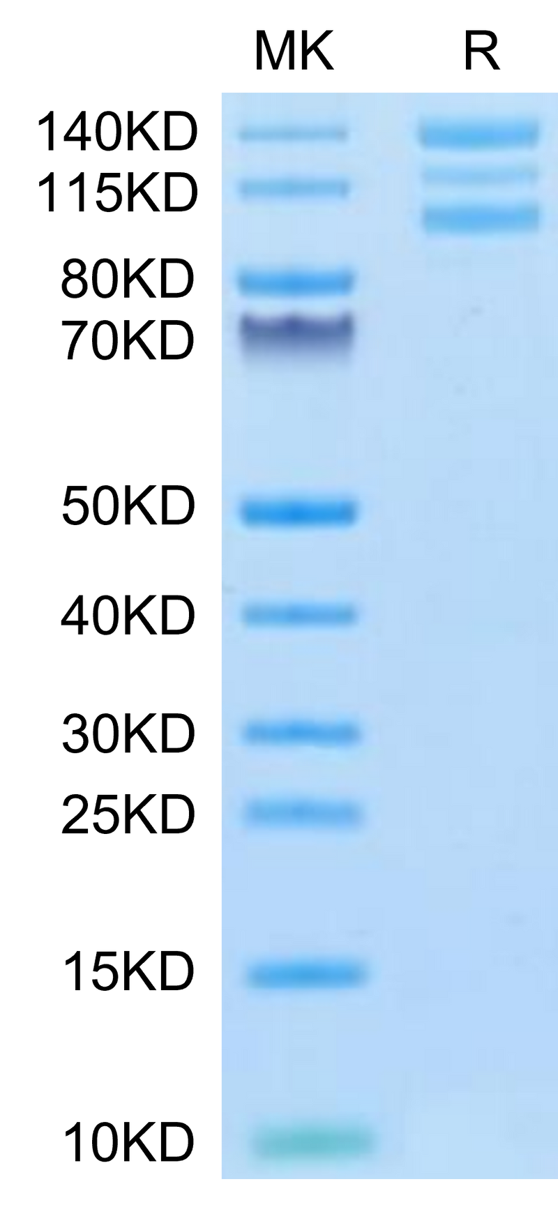 Human ITGAV&ITGB6 on Tris-Bis PAGE under reduced conditions. The purity is greater than 95%.Recombinant Human Integrin alpha V beta 6 (ITGAV&ITGB6) Heterodimer Protein, Active