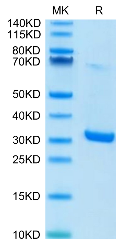 Human HMGB1 on Tris-Bis PAGE under reduced condition. The purity is greater than 95%.Recombinant Human HMGB1 Protein