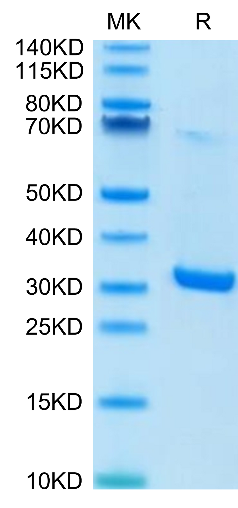 Human HMGB1 on Tris-Bis PAGE under reduced condition. The purity is greater than 95%.Recombinant Human HMGB1 Protein
