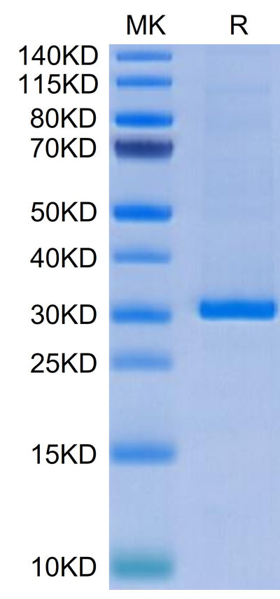 Human FGL1 on Tris-Bis PAGE under reduced condition. The purity is greater than 95%.Recombinant Human FGL1 Protein, Active