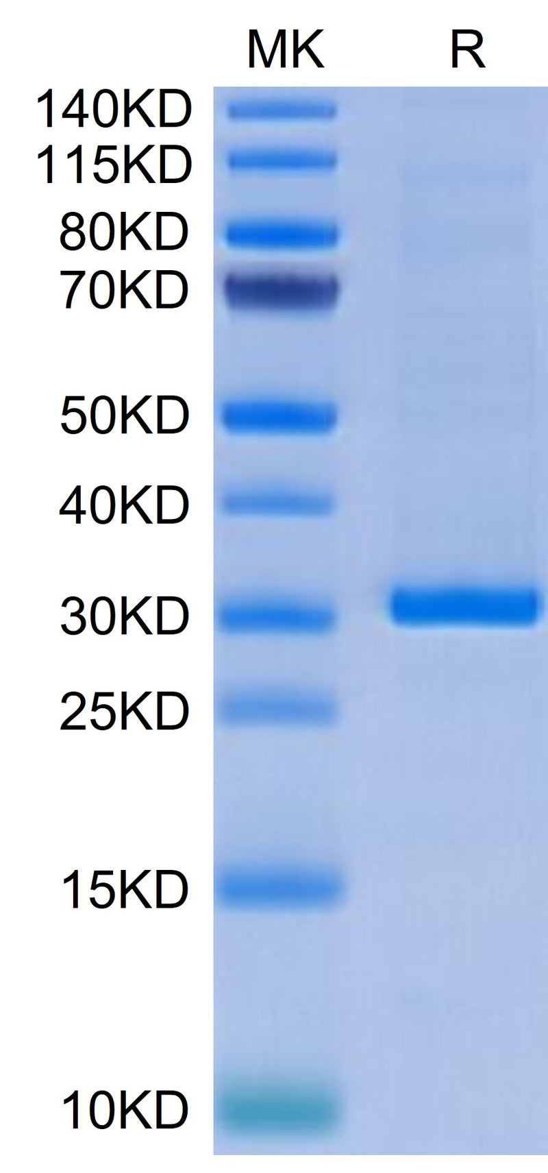 Human FGL1 on Tris-Bis PAGE under reduced condition. The purity is greater than 95%.Recombinant Human FGL1 Protein, Active