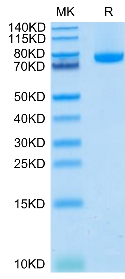 Human BAFF (Trimer) on Tris-Bis PAGE under reduced condition. The purity is greater than 95%.Recombinant Human BAFF/TNFSF13B/CD257 Trimer Protein, Active