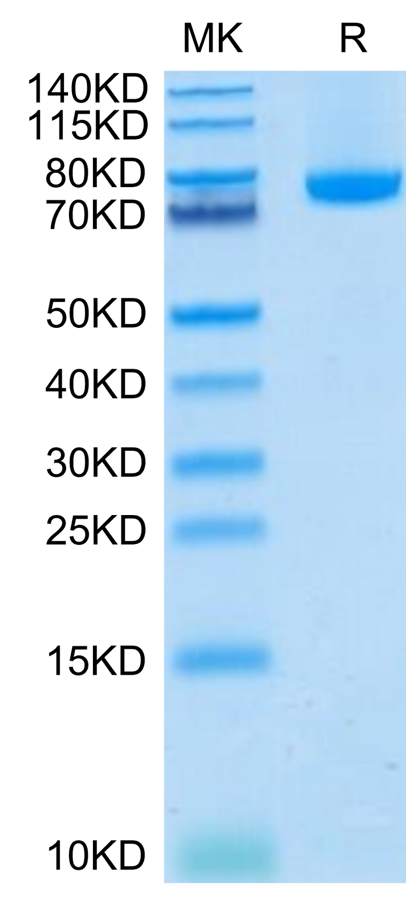 Human BAFF (Trimer) on Tris-Bis PAGE under reduced condition. The purity is greater than 95%.Recombinant Human BAFF/TNFSF13B/CD257 Trimer Protein, Active