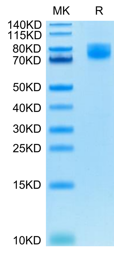 Human B7-2 on Tris-Bis PAGE under reduced condition. The purity is greater than 95%.Recombinant Human B7-2/CD86 Protein, Active