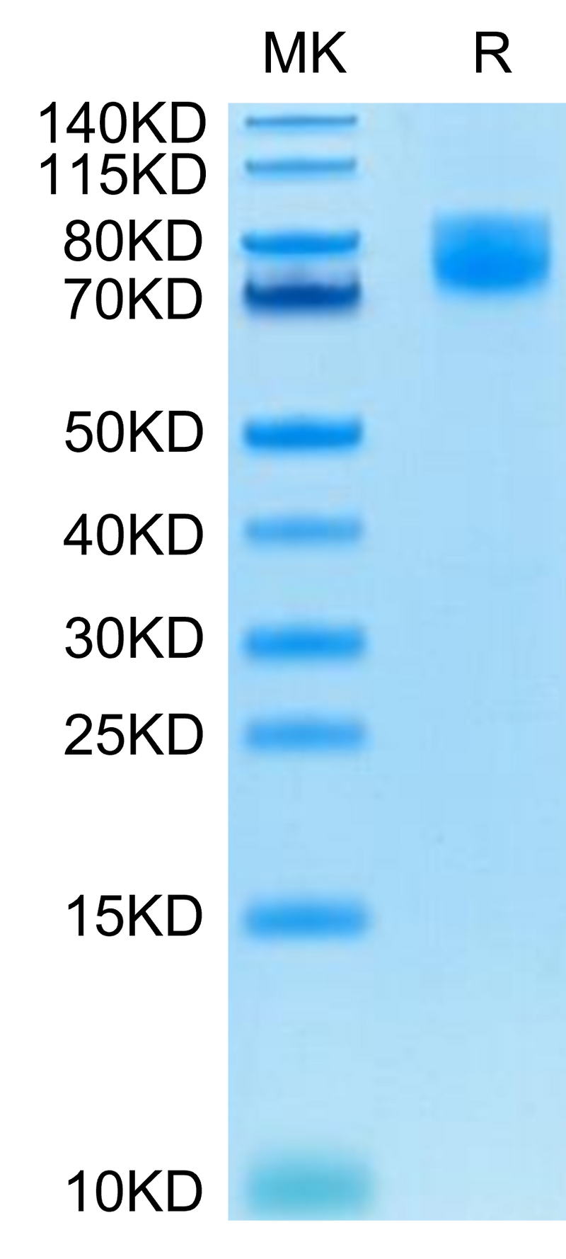 Human B7-2 on Tris-Bis PAGE under reduced condition. The purity is greater than 95%.Recombinant Human B7-2/CD86 Protein, Active