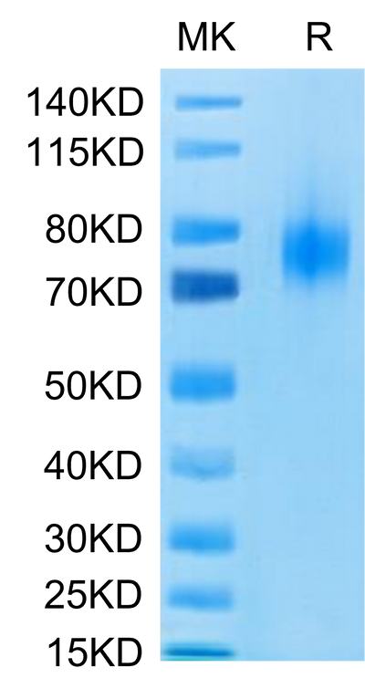 Human B7-1 on Tris-Bis PAGE under reduced condition. The purity is greater than 95%.Recombinant Human B7-1/CD80 Protein, Active