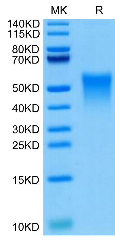 Cynomolgus TREM1 on Tris-Bis PAGE under reduced condition. The purity is greater than 95%.Recombinant Cynomolgus TREM1 Protein, Active