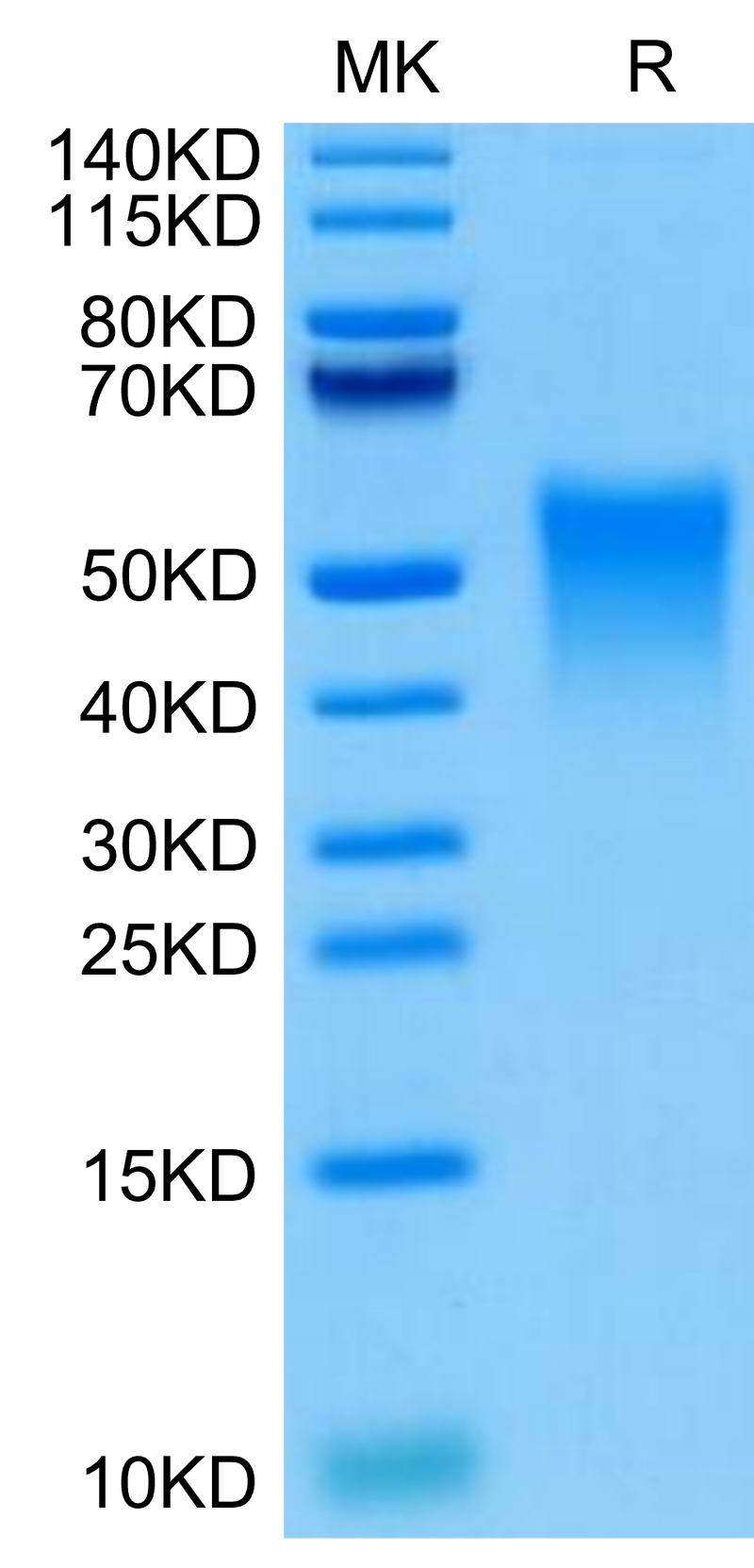 Cynomolgus TREM1 on Tris-Bis PAGE under reduced condition. The purity is greater than 95%.Recombinant Cynomolgus TREM1 Protein, Active