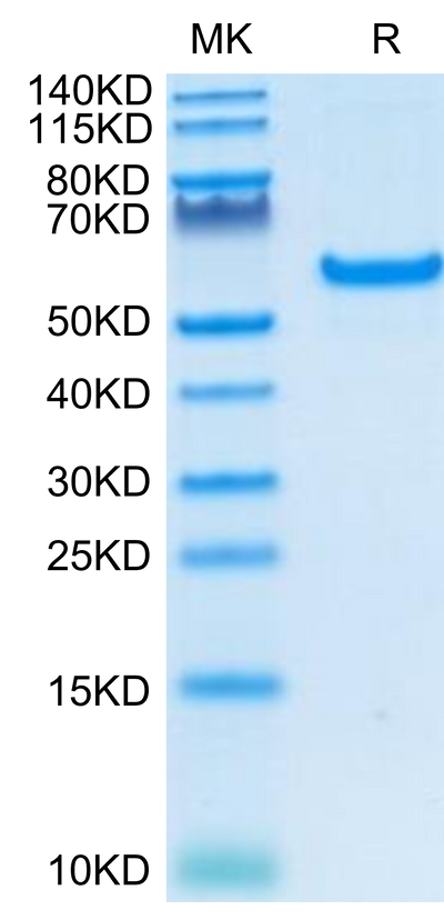 Human CD40 on Tris-Bis PAGE under reduced condition. The purity is greater than 95%.Recombinant Human CD40/TNFRSF5 Protein, Active