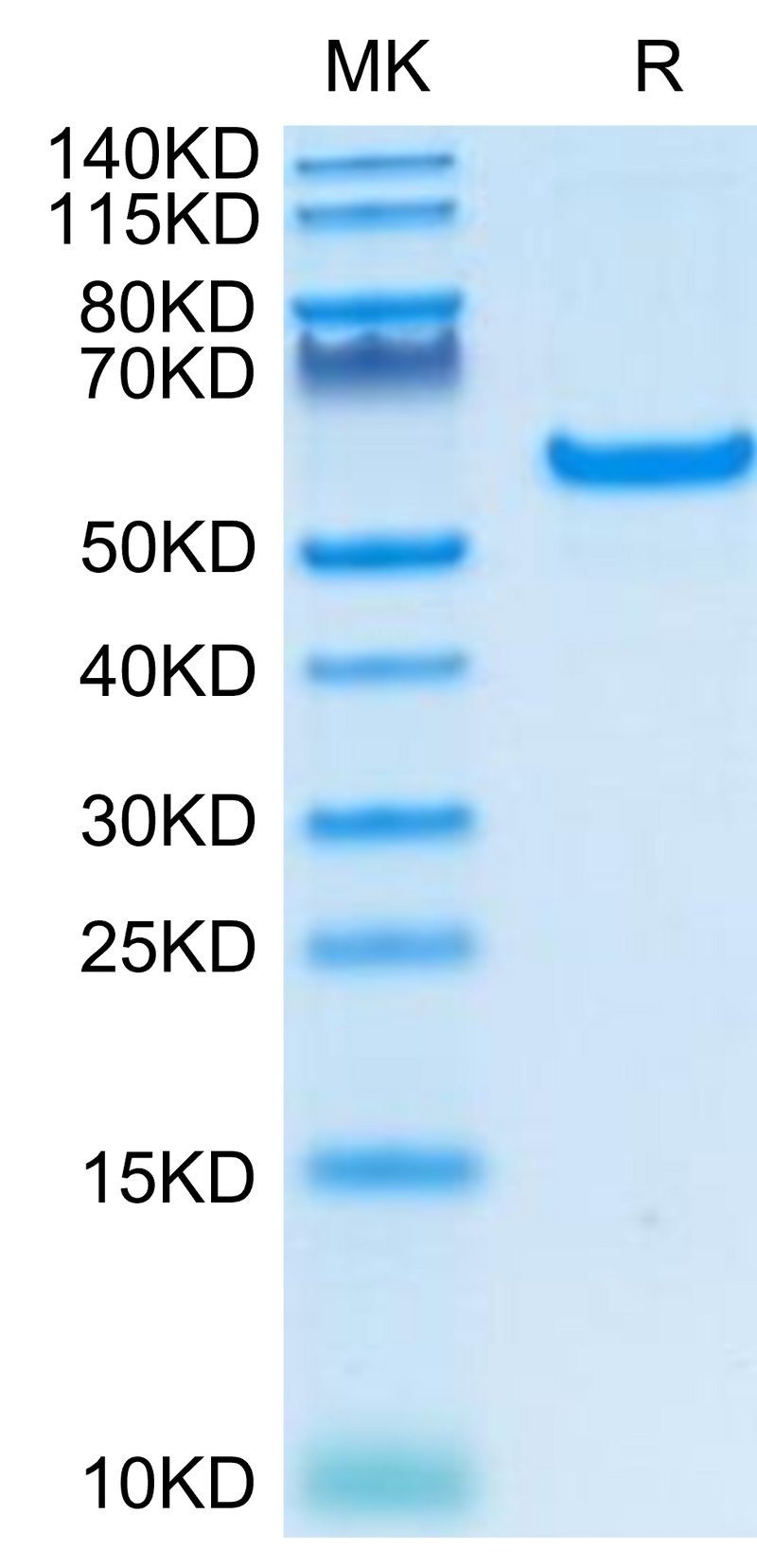 Human CD40 on Tris-Bis PAGE under reduced condition. The purity is greater than 95%.Recombinant Human CD40/TNFRSF5 Protein, Active