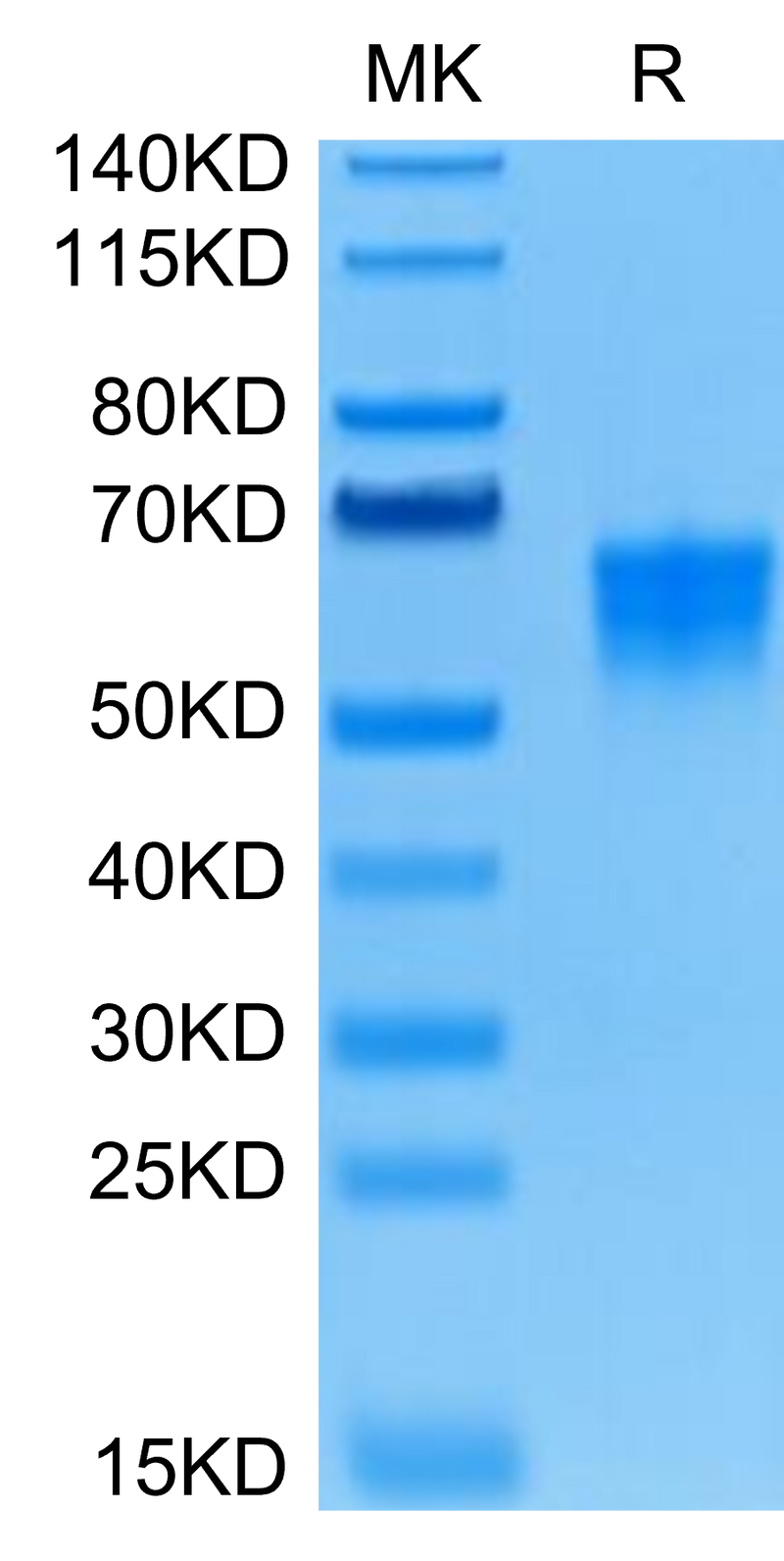 Human B7-H4 on Tris-Bis PAGE under reduced condition. The purity is greater than 95%.Recombinant Human B7-H4 Protein, Active