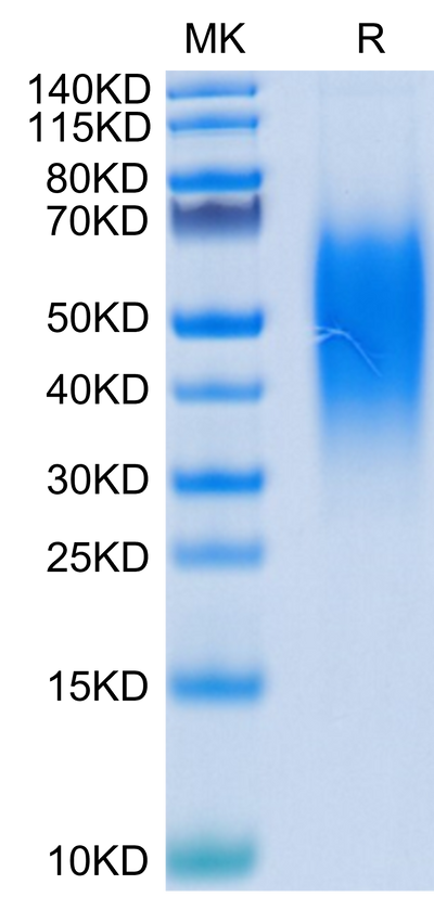 Human B7-H5 on Tris-Bis PAGE under reduced condition. The purity is greater than 95%.Recombinant Human B7-H5/Gi24/VISTA Protein, Active