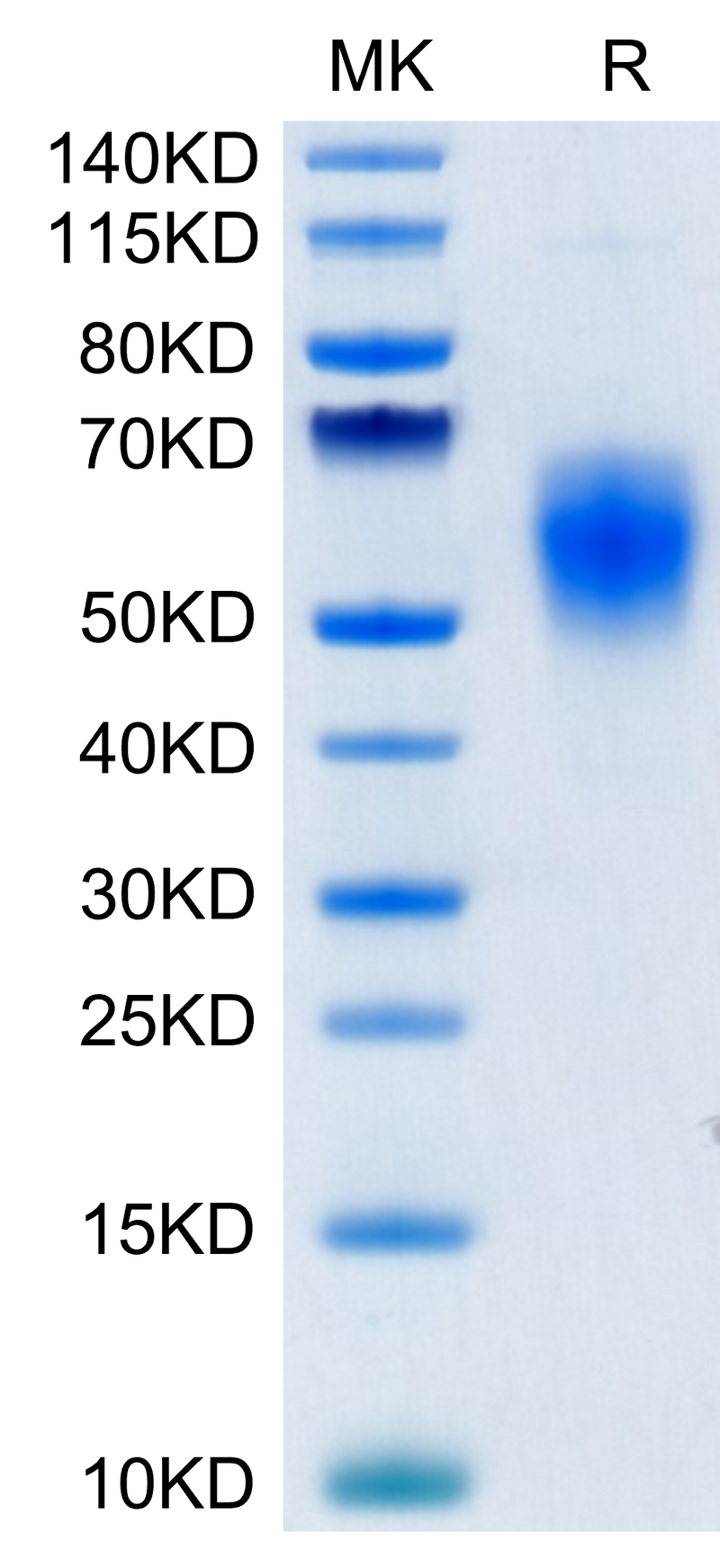 Human B7-H6 on Tris-Bis PAGE under reduced condition. The purity is greater than 95%.Recombinant Human B7-H6/NCR3LG1 Protein, Active