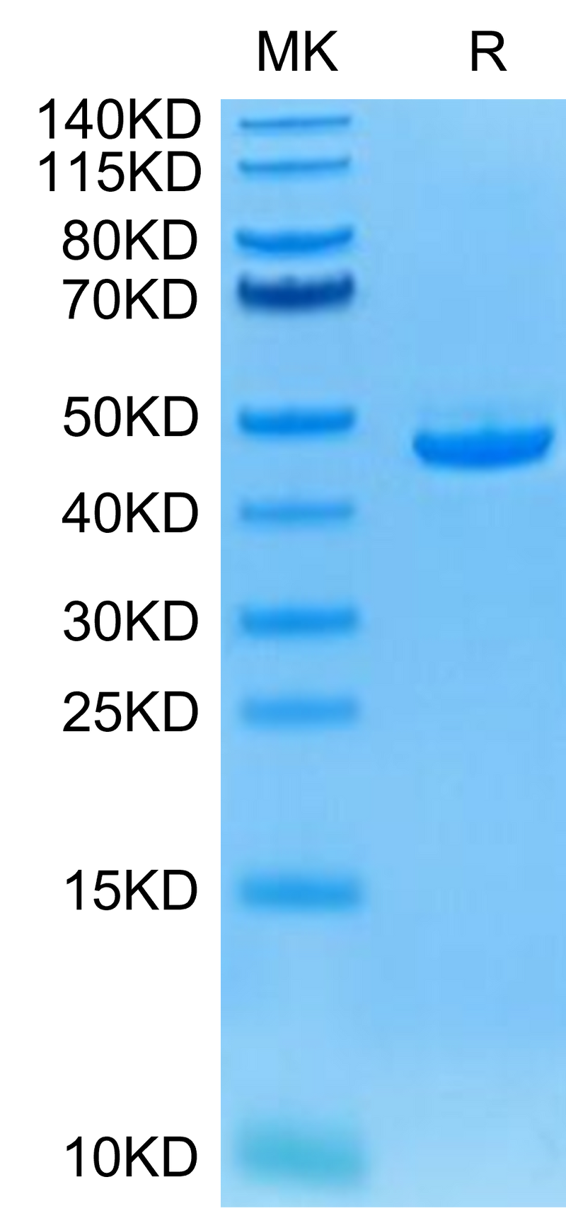 Human BAFF on Tris-Bis PAGE under reduced condition. The purity is greater than 95%.Recombinant Human BAFF/TNFSF13B/CD257 Protein, Active