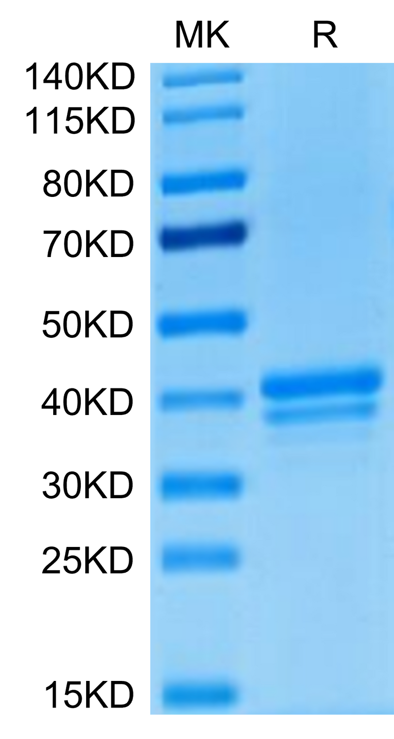 Human BCMA on Tris-Bis PAGE under reduced condition. The purity is greater than 95%.Recombinant Human BCMA/TNFRSF17 Protein, Active
