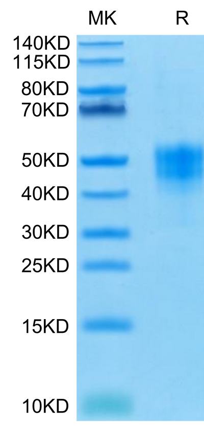 Human TROP-2 on Tris-Bis PAGE under reduced condition. The purity is greater than 95%.Recombinant Human TROP-2/TACSTD2 Protein, Active
