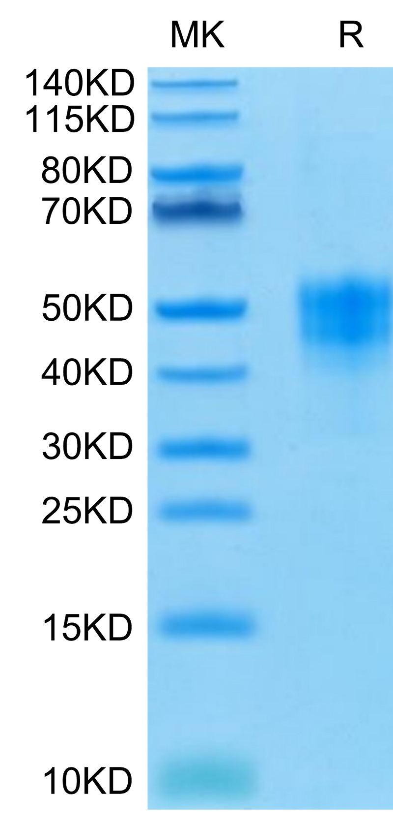 Human TROP-2 on Tris-Bis PAGE under reduced condition. The purity is greater than 95%.Recombinant Human TROP-2/TACSTD2 Protein, Active