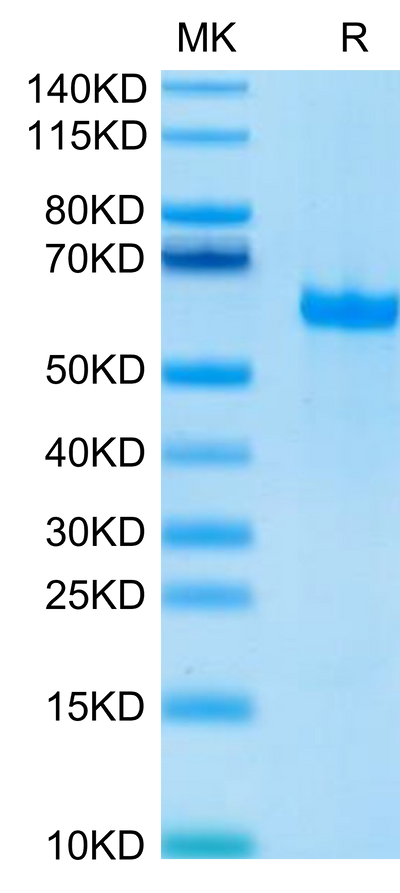 Human FGL1 on Tris-Bis PAGE under reduced condition. The purity is greater than 95%.Recombinant Human FGL1 Protein, Active