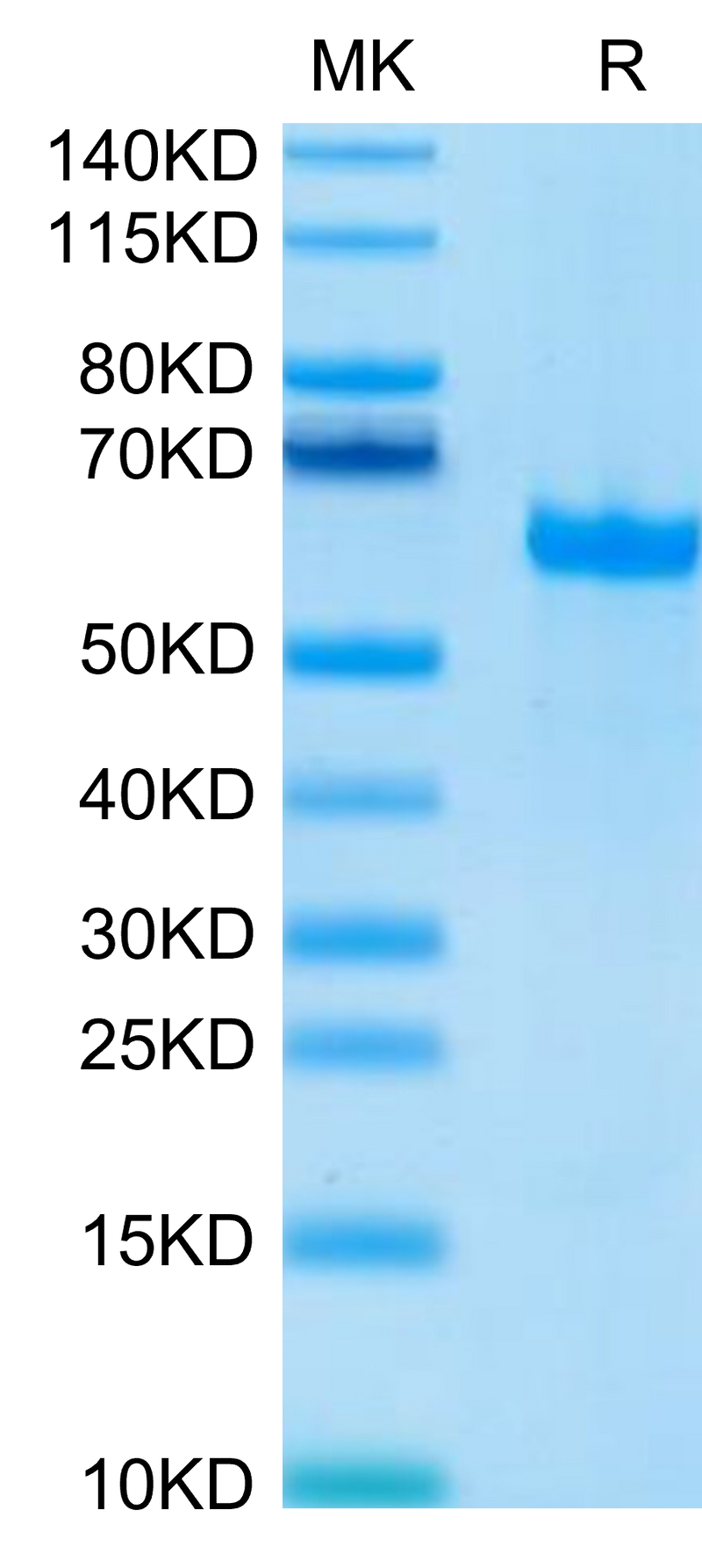 Human FGL1 on Tris-Bis PAGE under reduced condition. The purity is greater than 95%.Recombinant Human FGL1 Protein, Active