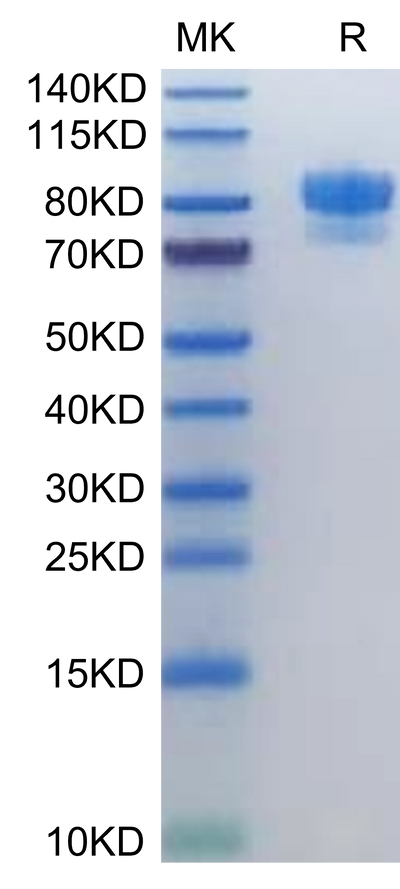 Human SIRP alpha on Tris-Bis PAGE under reduced condition. The purity is greater than 95%.Recombinant Human SIRP alpha/CD172a Protein, Active
