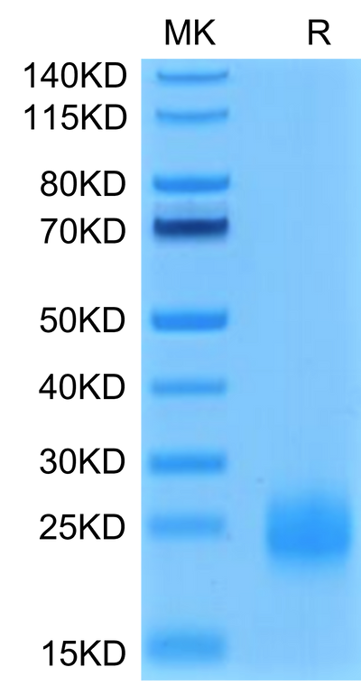 Human TIGIT on Tris-Bis PAGE under reduced condition. The purity is greater than 95%.Recombinant Human TIGIT Protein, Active