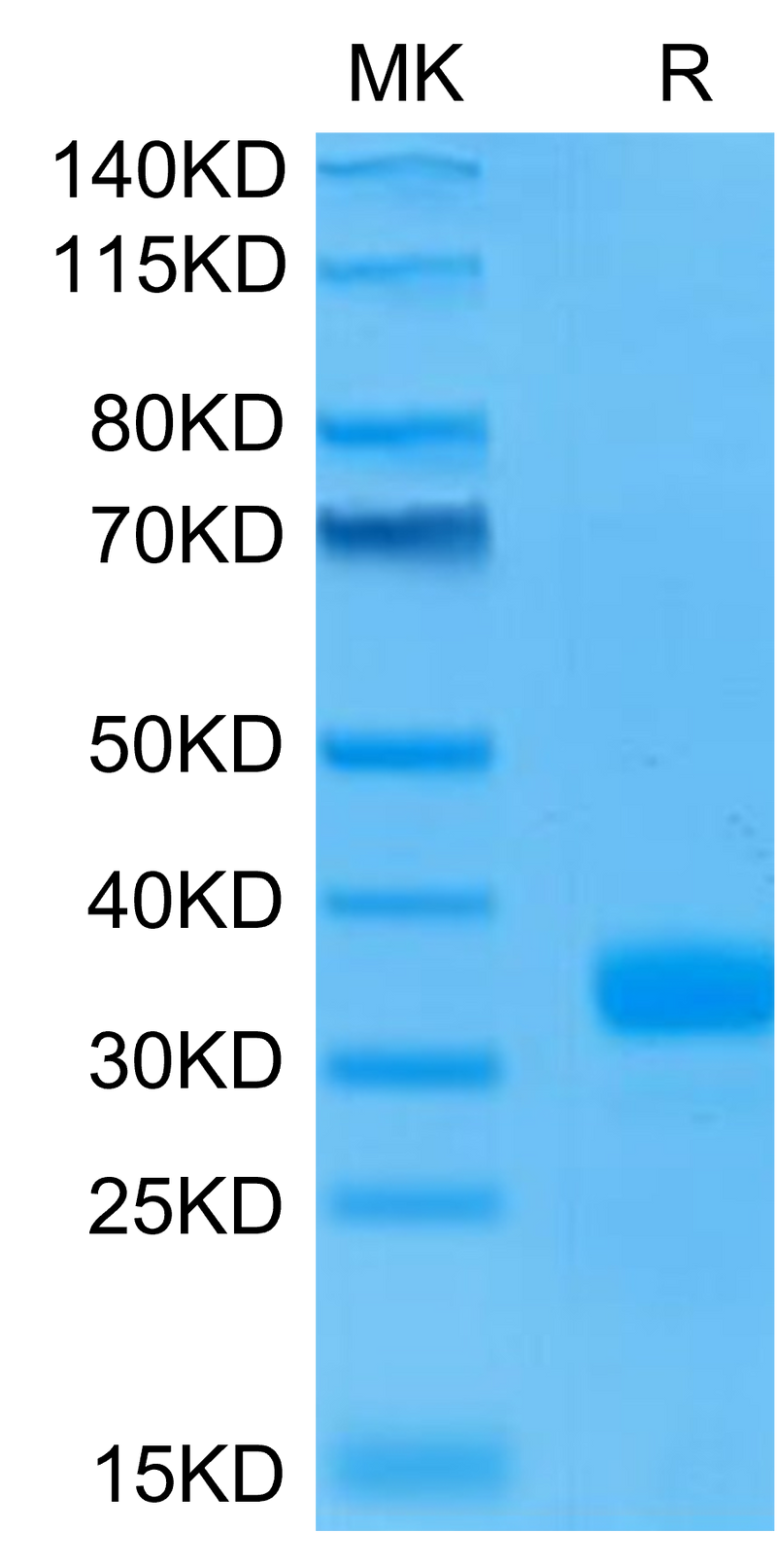 Human ANGPT2 on Tris-Bis PAGE under reduced condition. The purity is greater than 95%.Recombinant Human ANGPT2/Angiopoietin-2 Protein, Active