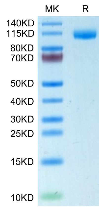 Human Siglec-2/CD22 on Tris-Bis PAGE under reduced condition. The purity is greater than 95%.Recombinant Human Siglec-2/CD22 Protein, Active