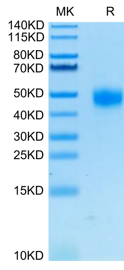 Human CD38 on Tris-Bis PAGE under reduced condition. The purity is greater than 95%.Recombinant Human CD38 Protein, Active