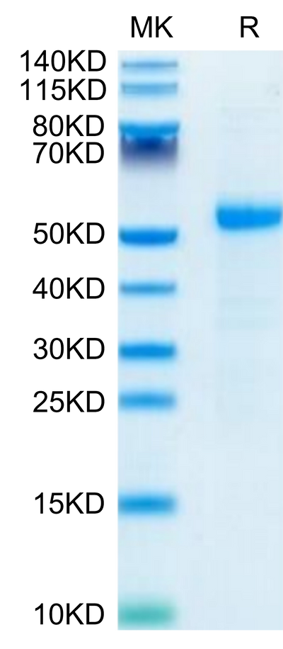 Human DLL3 on Tris-Bis PAGE under reduced- condition. The purity is greater than 95%.Recombinant Human DLL3 Protein, Active