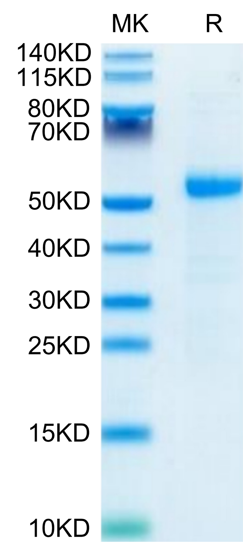 Human DLL3 on Tris-Bis PAGE under reduced- condition. The purity is greater than 95%.Recombinant Human DLL3 Protein, Active