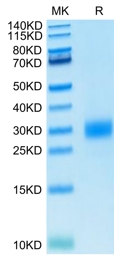 Human CTLA-4 on Tris-Bis PAGE under reduced condition. The purity is greater than 95%..Recombinant Human CTLA-4/CD152 Protein, Active