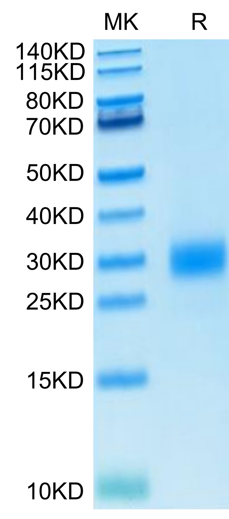 Human CTLA-4 on Tris-Bis PAGE under reduced condition. The purity is greater than 95%..Recombinant Human CTLA-4/CD152 Protein, Active