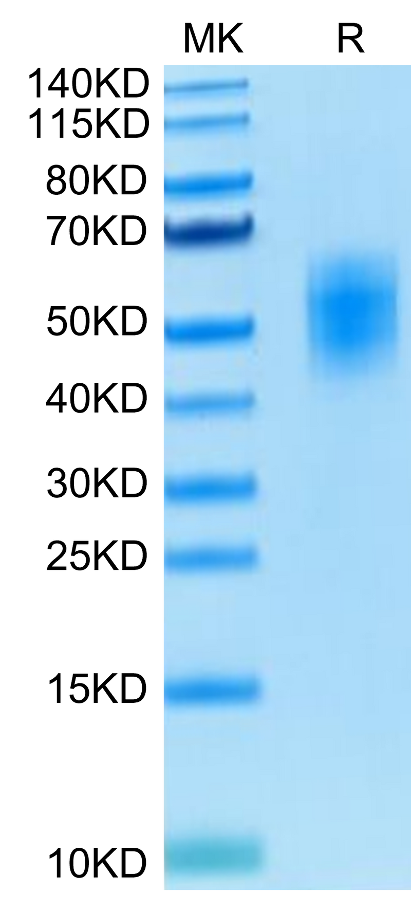 Human DNAM-1 on Tris-Bis PAGE under reduced condition. The purity is greater than 95%.Recombinant Human DNAM-1/CD226 Protein, Active
