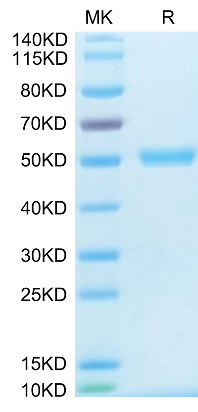 Human CD40 Ligand Trimer on Tris-Bis PAGE under reduced condition. The purity is greater than 95%.Recombinant Human CD40 Ligand/TNFSF5 Trimer Protein, Active