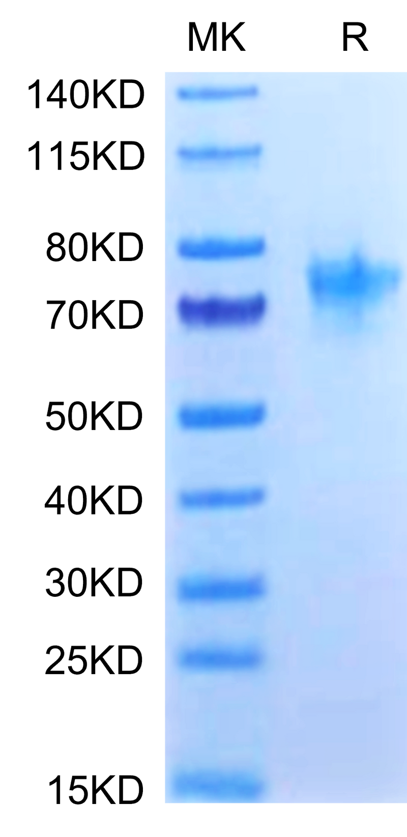 Human OX40 on Tris-Bis PAGE under reduced condition. The purity is greater than 95%.Recombinant Human OX40/TNFRSF4/CD134 Protein, Active