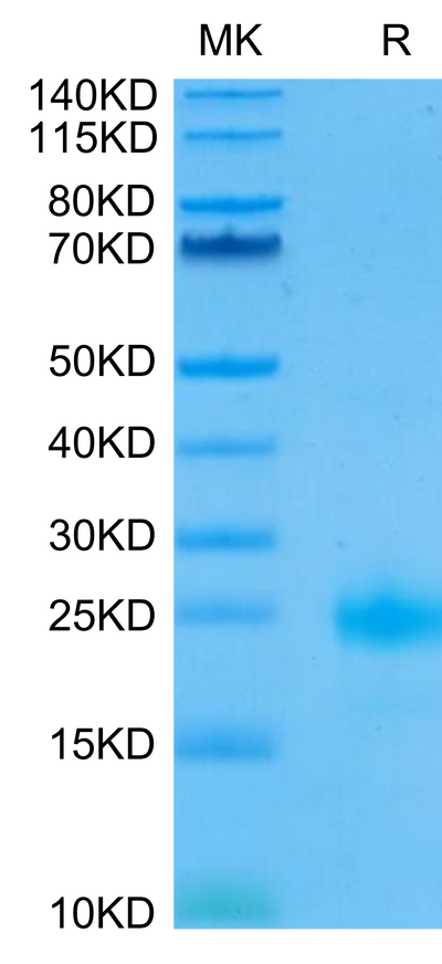 Biotinylated IL-4 on Tris-Bis PAGE under reduced condition. The purity is greater than 95%.Biotinylated Human IL-4 Protein, Active
