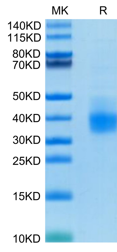 Human PD-L1 on Tris-Bis PAGE under reduced condition. The purity is greater than 95%.Recombinant Human PD-L1/B7-H1 Protein, Active